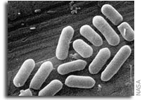 Physiological effects of reduced gravity on bacteria