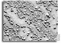 Mars Exploration Rover Opportunity Update 10 February 2006