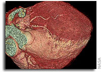 NASA Image Fusion Will Help Doctors Examine Astronauts' Hearts in Space