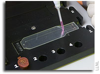 Tricorder Identifies Viruses and Microorganisms Within 24 hours