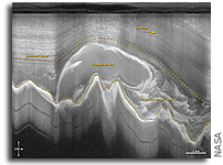 Bottoms Up for Antarctic Ice